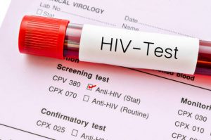 Hiv test aanschaffen